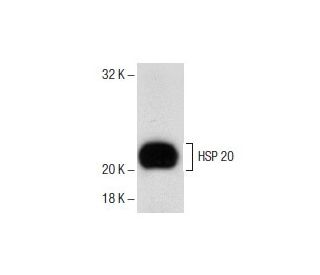 rat heart extract: sc-2393. Western blot analysis of HSP 20... 