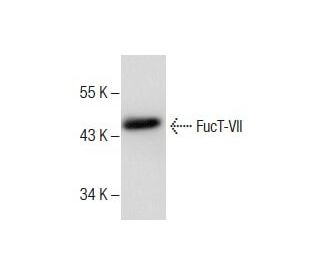 rat kidney extract: sc-2394. Western blot analysis of FucT-VII expression... 