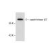 rat liver extract: sc-2395. Western blot analysis of casein kinase...