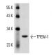 rat lung extract: sc-2396. Western blot analysis of TREM-1 expression...