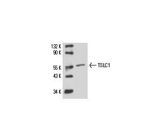 rat lung extract: sc-2396. Western blot analysis of TSLC1 expression... 