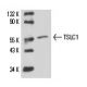 rat lung extract: sc-2396. Western blot analysis of TSLC1 expression... 