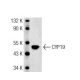 rat ovary extract: sc-2399. Western blot analysis of CYP19 expression...