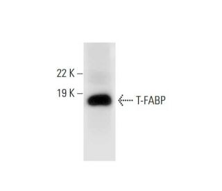 T-FABP Antibody (D-8) - Western Blotting - Image 289535 