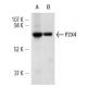 P2X4 (H-40): sc-28764. Western blot analysis of P2X4 expression in rat (A) and mouse (B) thymus tissue extracts.