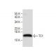 TC1 (C-13): sc-98165. Western blot analysis of TC1 expression in rat thyroid tissue extracts. 