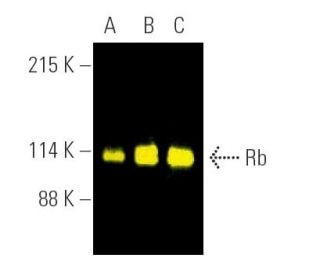 Rb Antibody (IF8) - Western Blotting - Image 390155 