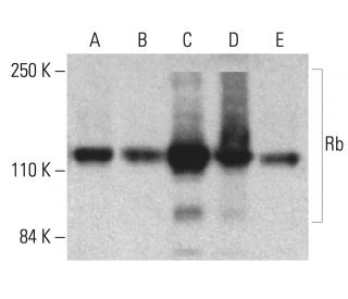 Rb Antibody (Rb1) - Western Blotting - Image 401701 