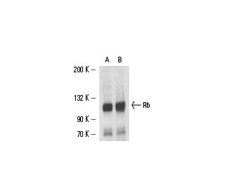 Rb Antibody (XZ55) - Western Blotting - Image 15594 