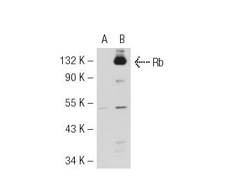 Rb (RB1AD56A): sc-81366. Western blot analysis of Rb expression in... 