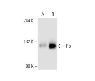Rb (C-2): sc-74562. Western blot analysis of Rb expression in... 