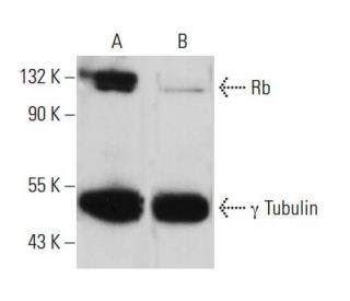 Rb siRNA (h): sc-29468. Western blot analysis of Rb expression in non-transfected control (A) and Rb siRNA transfected (B) 