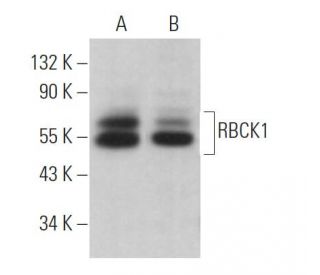 RBCK1 Antibody (H-1) - Western Blotting - Image 362940