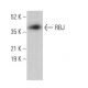 RBJ Antibody (E-2) - Western Blotting - Image 370132 