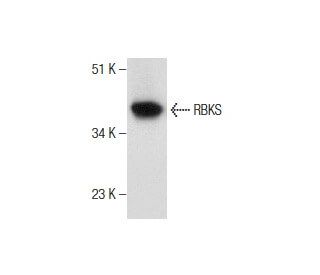 RBKS Antibody (F-9) - Western Blotting - Image 159367 