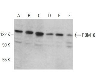 RBM10 Antibody (H-4) - Western Blotting - Image 379185 