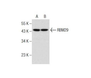 RBM29 Antibody (D-2) - Western Blotting - Image 158471 