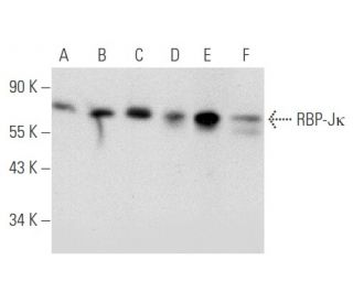 RBP-Jκ Antibody (E-7) - Western Blotting - Image 356583Each CRISPR/Cas9 Knockout (KO) Plasmid product consists of a pool of 3 plasmids designed to ensure identification and cleavage of a specific gene for maximum knockout efficiency. Each plasmid encodes a unique 20 nt sequence derived from the GeCKO (v2) library.