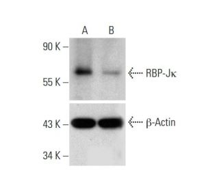 RBP-J kappa Double Nickase Plasmid (h): sc-401373-NIC. Western blot analysis of... 