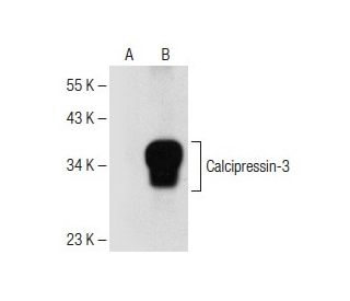 RCAN2/3 Antibody (F-7) - Western Blotting - Image 150651