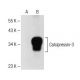 RCAN2/3 Antibody (F-7) - Western Blotting - Image 150651