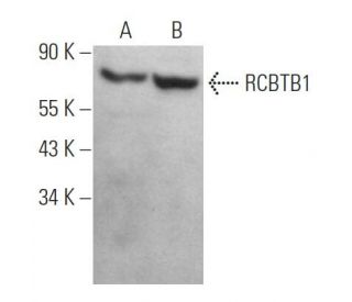RCBTB1 Antibody (G-2) - Western Blotting - Image 369029 