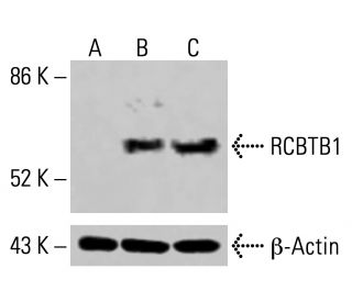 RCBTB1 Antibody (G-2) - Western Blotting - Image 414951 