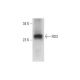 RD3 Antibody (A-9) - Western Blotting - Image 326501 