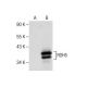 RDH5 Antibody (G-5) - Western Blotting - Image 281221