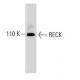 RECK Antibody (28) - Western Blotting - Image 127535