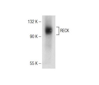 RECK Antibody (G-4) - Western Blotting - Image 147185 