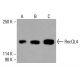 RecQL4 抗体 (B-3):sc-518189。HeLa (A)、K-562 (B) 和 HCT-116 (C) 全细胞裂解液中的RecQL4表达的Western blot分析。所用检测试剂:m-IgGκ BP-HRP:sc-516102。 RecQL4 Antibody (B-3) - Western Blotting - Image 416479
