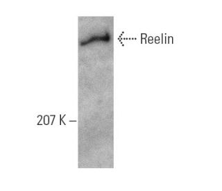 Reelin Antibody (E-5) - Western Blotting - Image 6173Each CRISPR/Cas9 Knockout (KO) Plasmid product consists of a pool of 3 plasmids designed to ensure identification and cleavage of a specific gene for maximum knockout efficiency. Each plasmid encodes a unique 20 nt sequence derived from the GeCKO (v2) library.