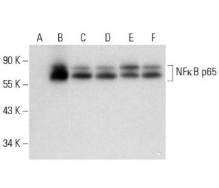 RELA/NFκB p65 Antibody (G-8) - Western Blotting - Image 304540