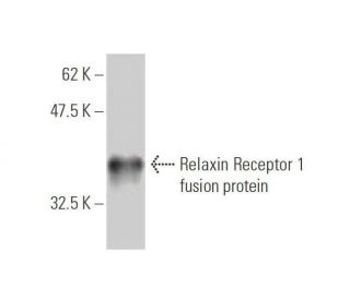 Relaxin Receptor 1 Antibody (3E3) - Western Blotting - Image 350256