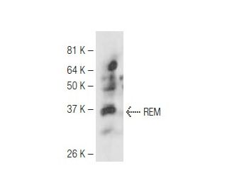 REM Antibody (24E4) - Western Blotting - Image 67297