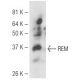 REM Antibody (24E4) - Western Blotting - Image 67297