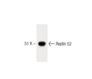 Reptin 52 Antibody (42) - Western Blotting - Image 60432 