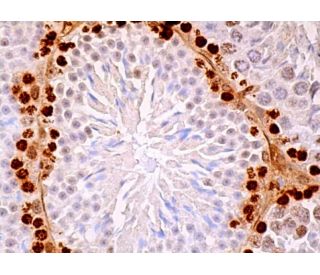 Rex-1 Antibody (F-1) - Immunohistochemistry - Image 379123 