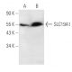 SLC19A1 Antibody (D-4) - Western Blotting - Image 291065 