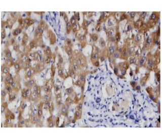 RGMc Antibody (1C12) - Immunohistochemistry - Image 346155 