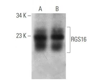 RGS16 Antibody (A-9) - Western Blotting - Image 360581 