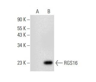 RGS16 Antibody (F-9) - Western Blotting - Image 301337