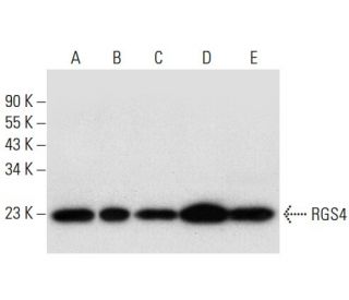 RGS4 Antibody (D-8) - Western Blotting - Image 308044 