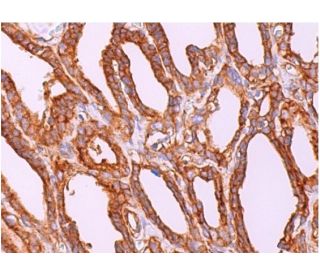RGS5 Antibody (B-4) - Immunohistochemistry - Image 377505 