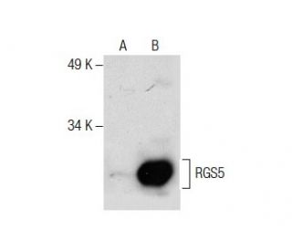 RGS5 Antibody (H-1) - Western Blotting - Image 287467