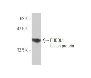 RHBDL1 Antibody (5B11) - Western Blotting - Image 348984