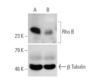 Rho B siRNA (m): sc-36415. Western blot analysis of Rho B expression in non-transfected control (A) and Rho B siRNA transf 