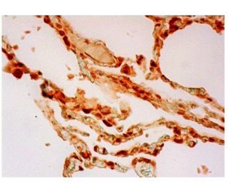 RhoC Antibody (C-10) - Immunohistochemistry - Image 348917 