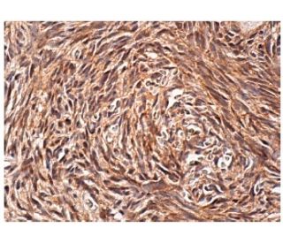 Rho D Antibody (H-1) - Immunohistochemistry - Image 158013 